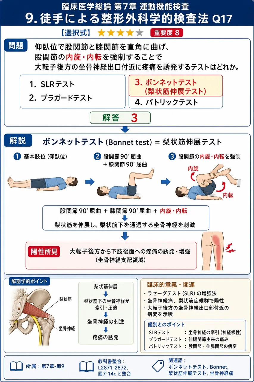 仰臥位で股関節と膝関節を直角に曲げ、股関節の内旋・内転を強制することで大転子後方の坐骨神経出口付近に疼痛を誘発するテストはどれか。 解説図