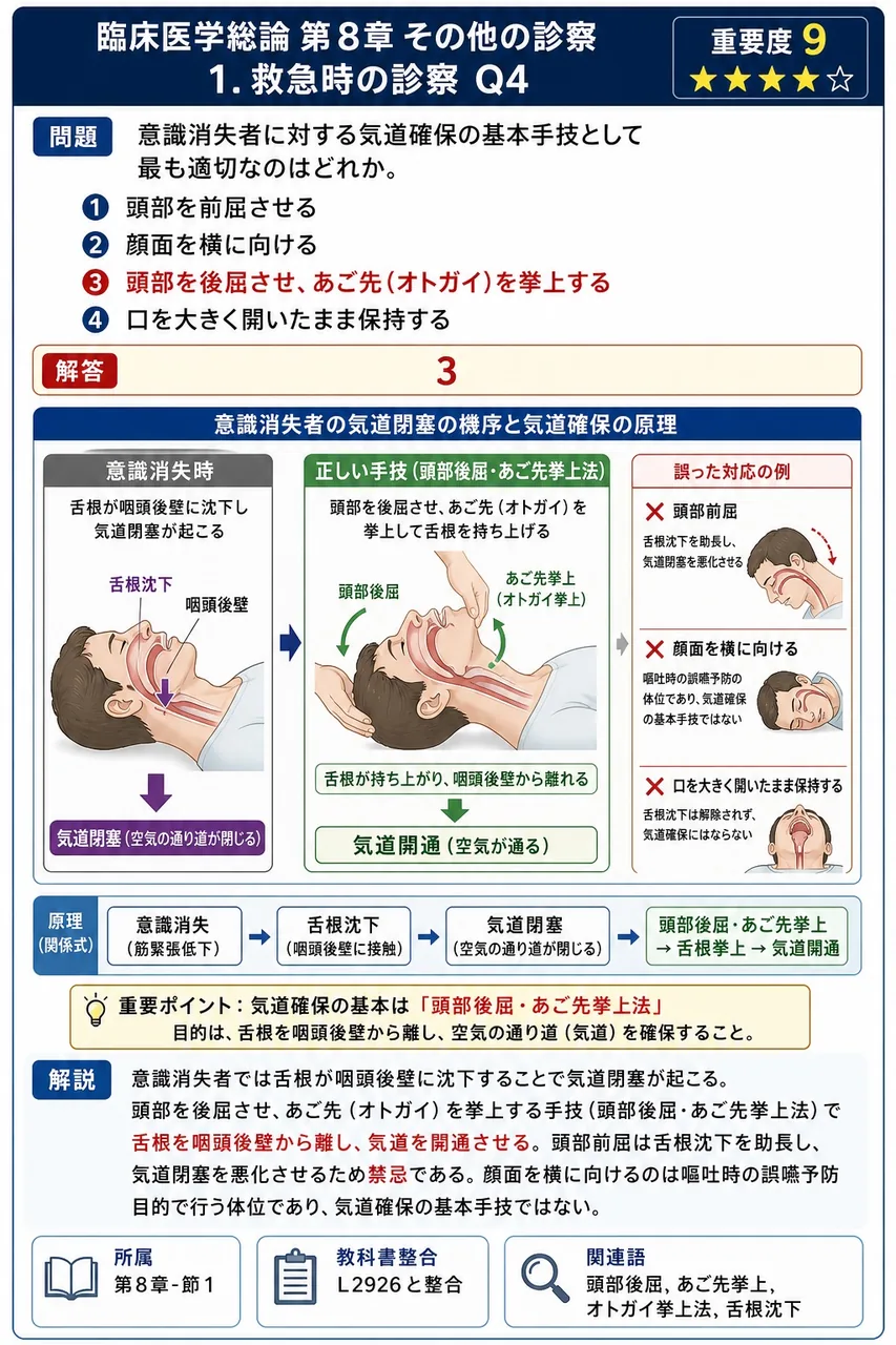 意識消失者に対する気道確保の基本手技として最も適切なのはどれか。 解説図