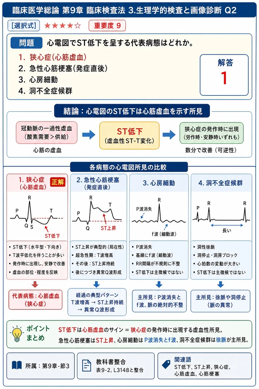 心電図でST低下を呈する代表病態はどれか。 解説図