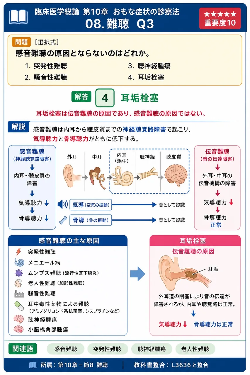 感音難聴の原因とならないのはどれか。 解説図