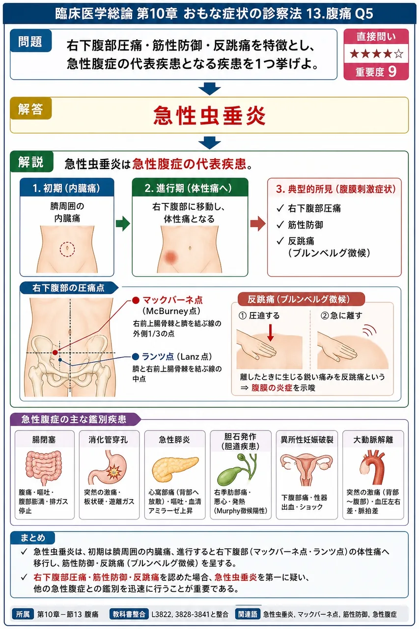 右下腹部圧痛・筋性防御・反跳痛を特徴とし、急性腹症の代表疾患となる疾患を1つ挙げよ。 解説図