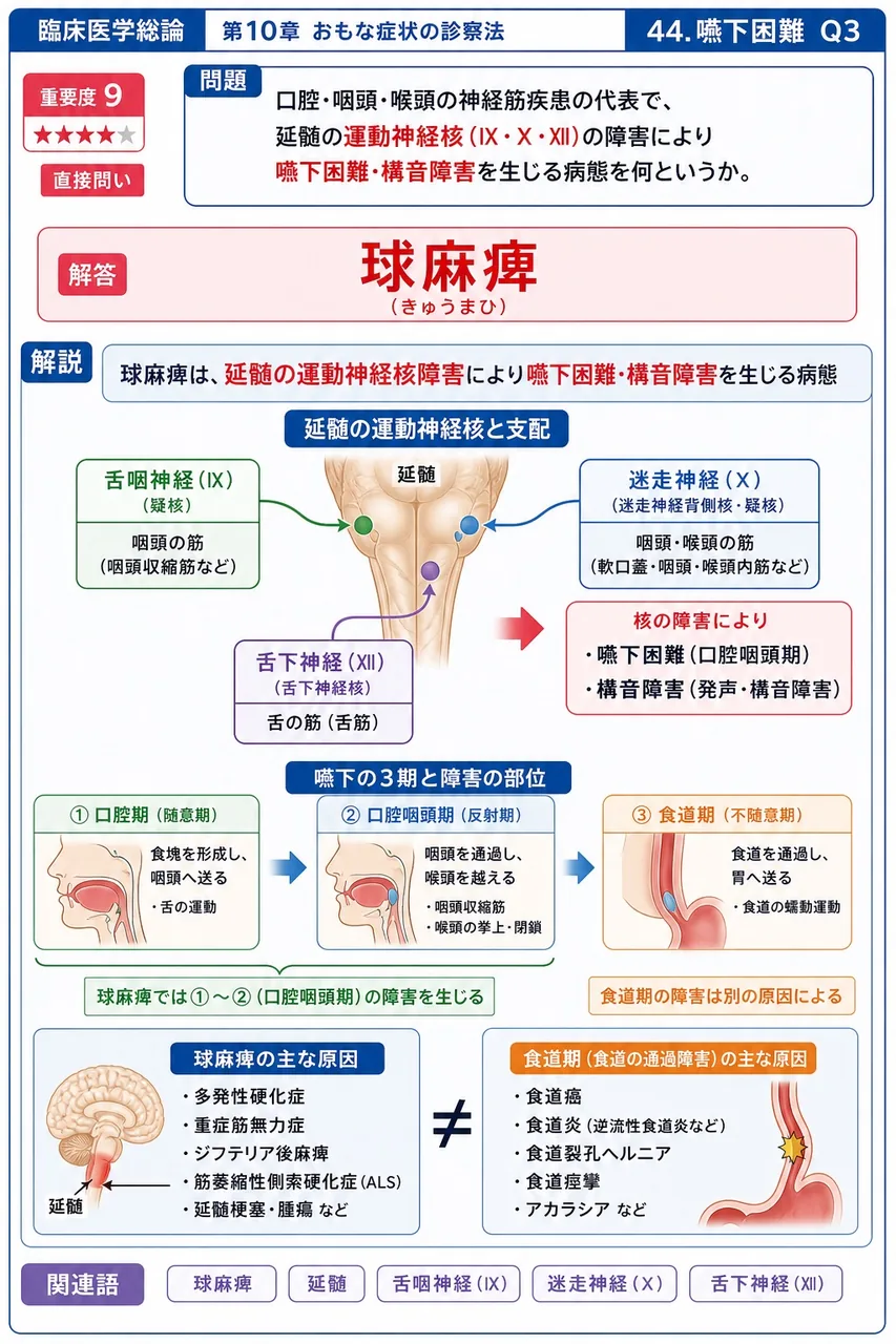 口腔・咽頭・喉頭の神経筋疾患の代表で、延髄の運動神経核(Ⅸ・Ⅹ・Ⅻ)の障害により嚥下困難・構音障害を生じる病態を何というか。 解説図