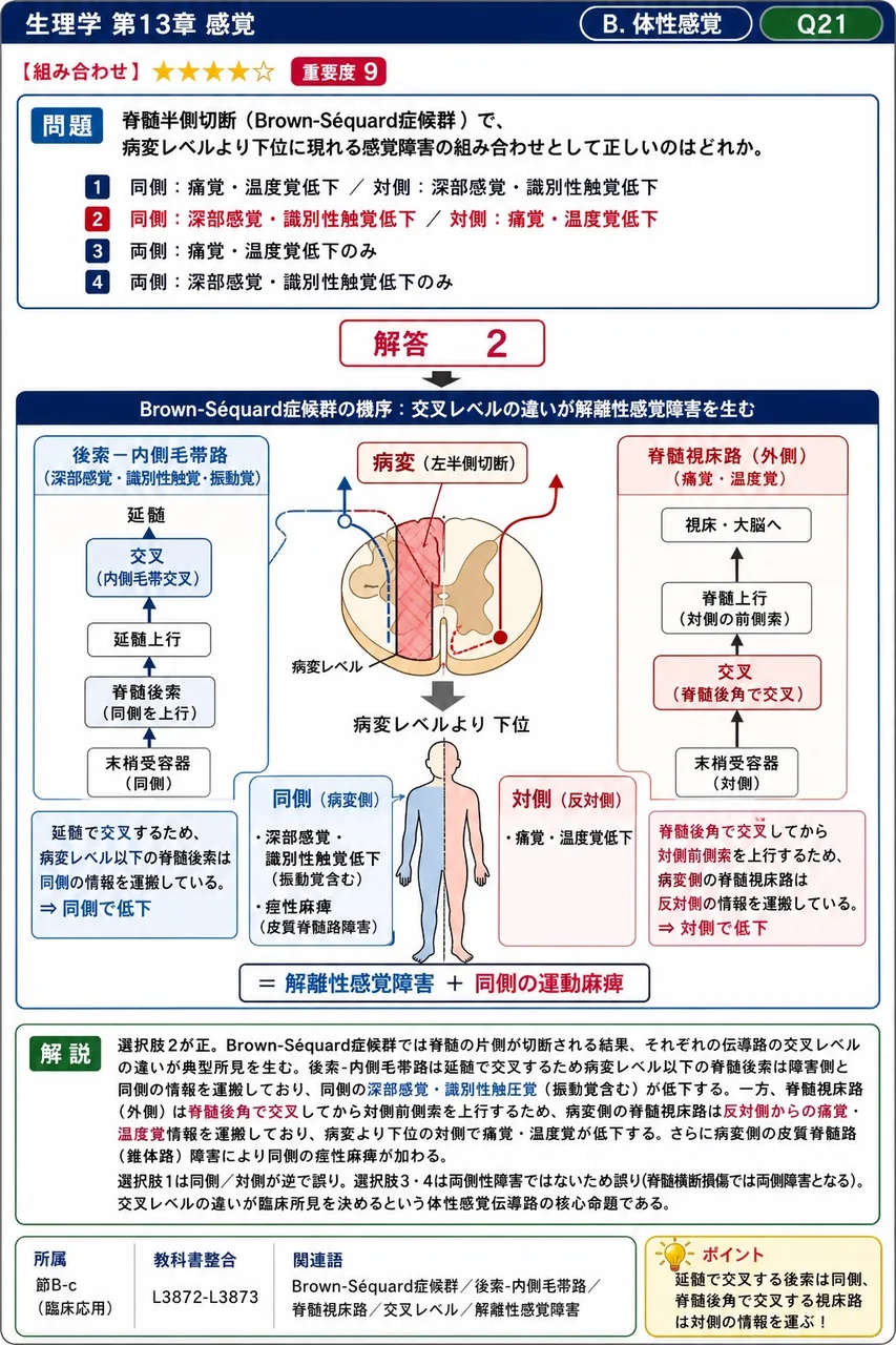 脊髄半側切断(Brown-Séquard症候群)で、病変レベルより下位に現れる感覚障害の組み合わせとして正しいのはどれか。 解説図