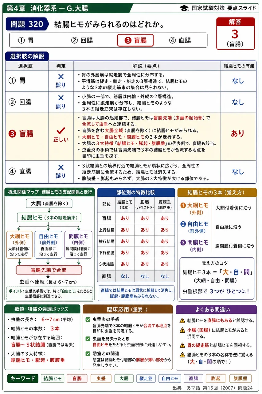 あマ指 第15回(2007) 問題24｜結腸ヒモがみられるのはどれか。 解説図