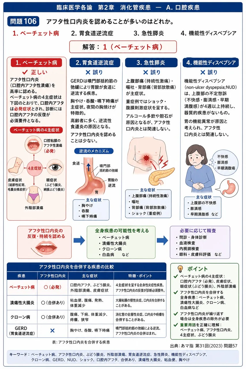 あマ指 第31回(2023) 問題57|アフタ性口内炎を認めることが多いのはどれか。 解説図