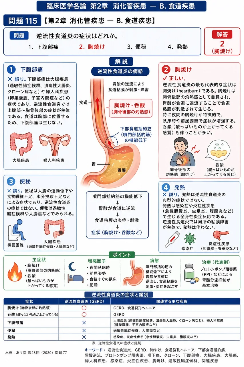 あマ指 第28回(2020) 問題77｜逆流性食道炎の症状はどれか。 解説図