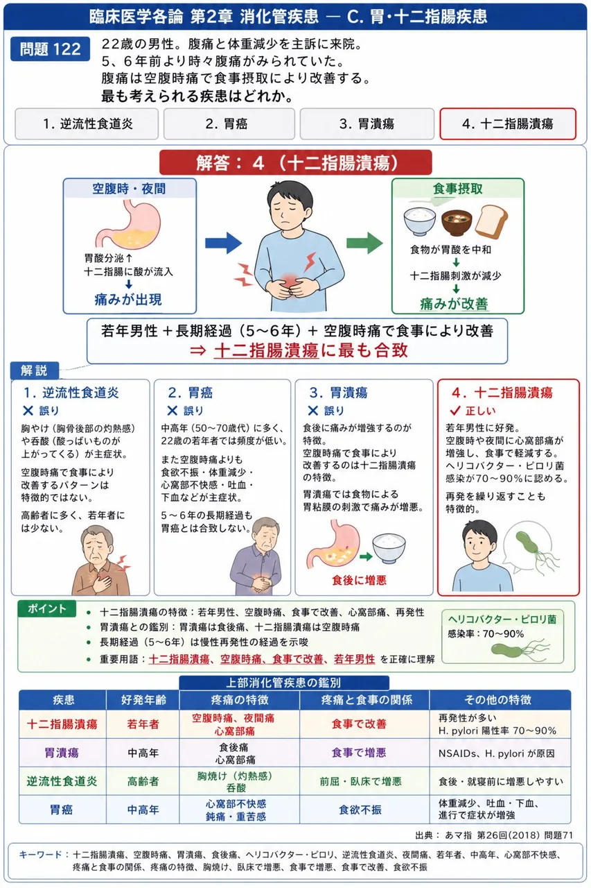 あマ指 第26回(2018) 問題71|「22歳の男性。腹痛と体重減少を主訴に来院。5、6年前より時々腹痛がみられていた。腹痛は空腹時痛で食事摂取により改善する。」最も考えられる疾患はどれか。 解説図