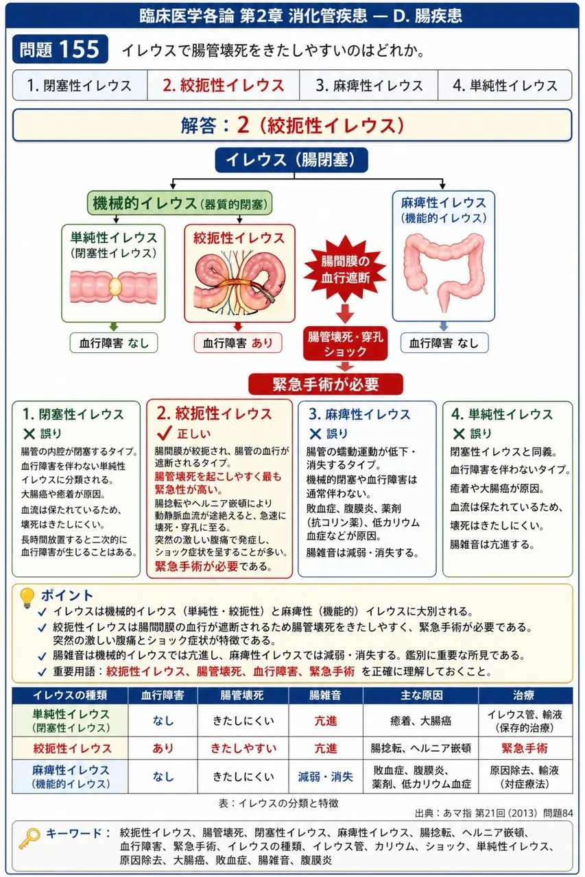 あマ指 第21回(2013) 問題84|イレウスで腸管壊死をきたしやすいのはどれか。 解説図