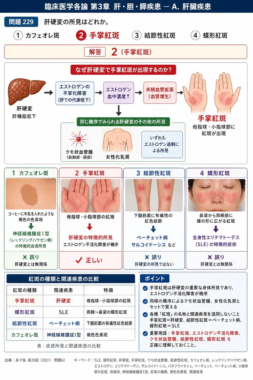 あマ指 第29回(2021) 問題62｜肝硬変の所見はどれか。 解説図