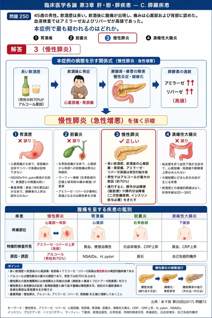 あマ指 第25回(2017) 問題72|「45歳の男性。飲酒歴は長い。飲酒後に腹痛が出現し、痛みは心窩部および背部に認めた。血液検査ではアミラーゼおよびリパーゼが高値であった。」本症例で最も疑われるのはどれか。 解説図