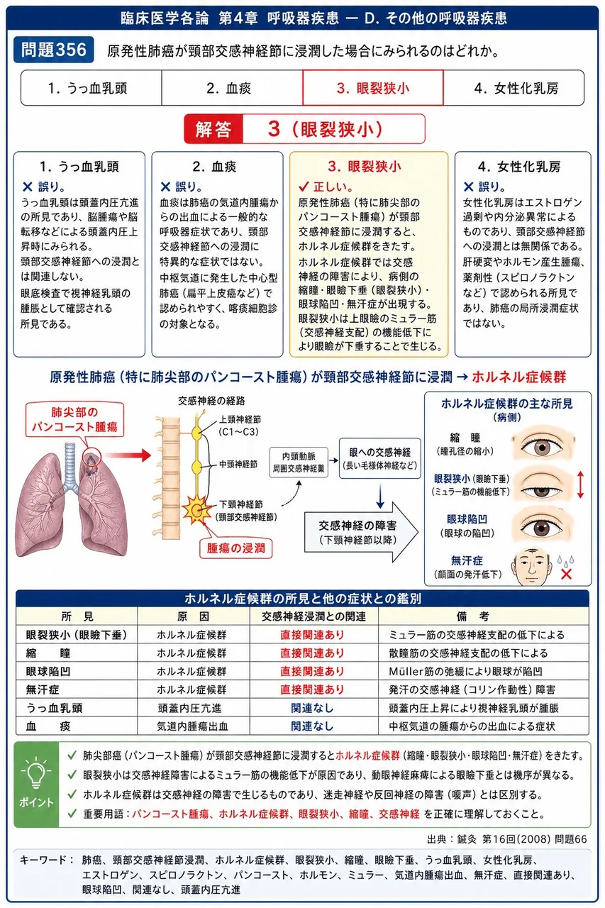 鍼灸 第16回(2008) 問題66|原発性肺癌が頸部交感神経節に浸潤した場合にみられるのはどれか。 解説図