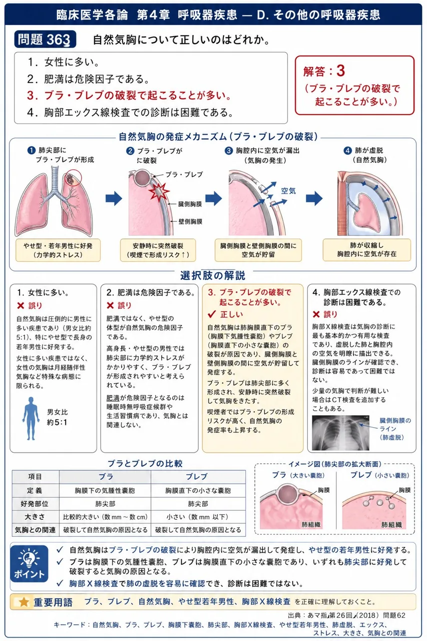あマ指 第26回(2018) 問題62|自然気胸について正しいのはどれか。 解説図