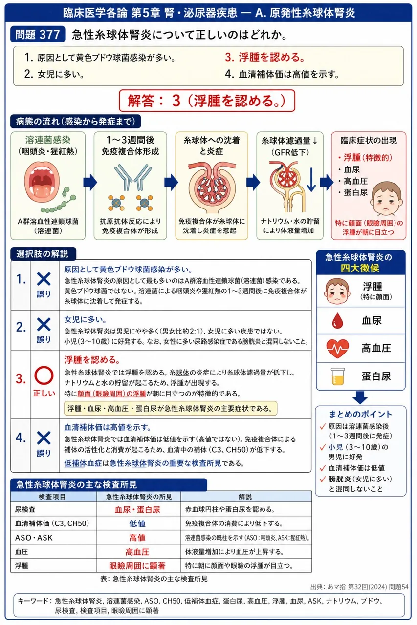 あマ指 第32回(2024) 問題54｜急性糸球体腎炎について正しいのはどれか。 解説図