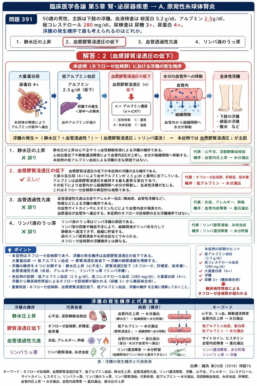 鍼灸 第26回(2018) 問題76|「50歳の男性。主訴は下肢の浮腫。血液検査は総蛋白5.2g/dl、アルブミン2.5g/dl、総コレステロール280mg/dl。尿検査は尿糖3+、尿蛋白4+。」浮腫の発生機序で最も考えられるのはどれか。 解説図