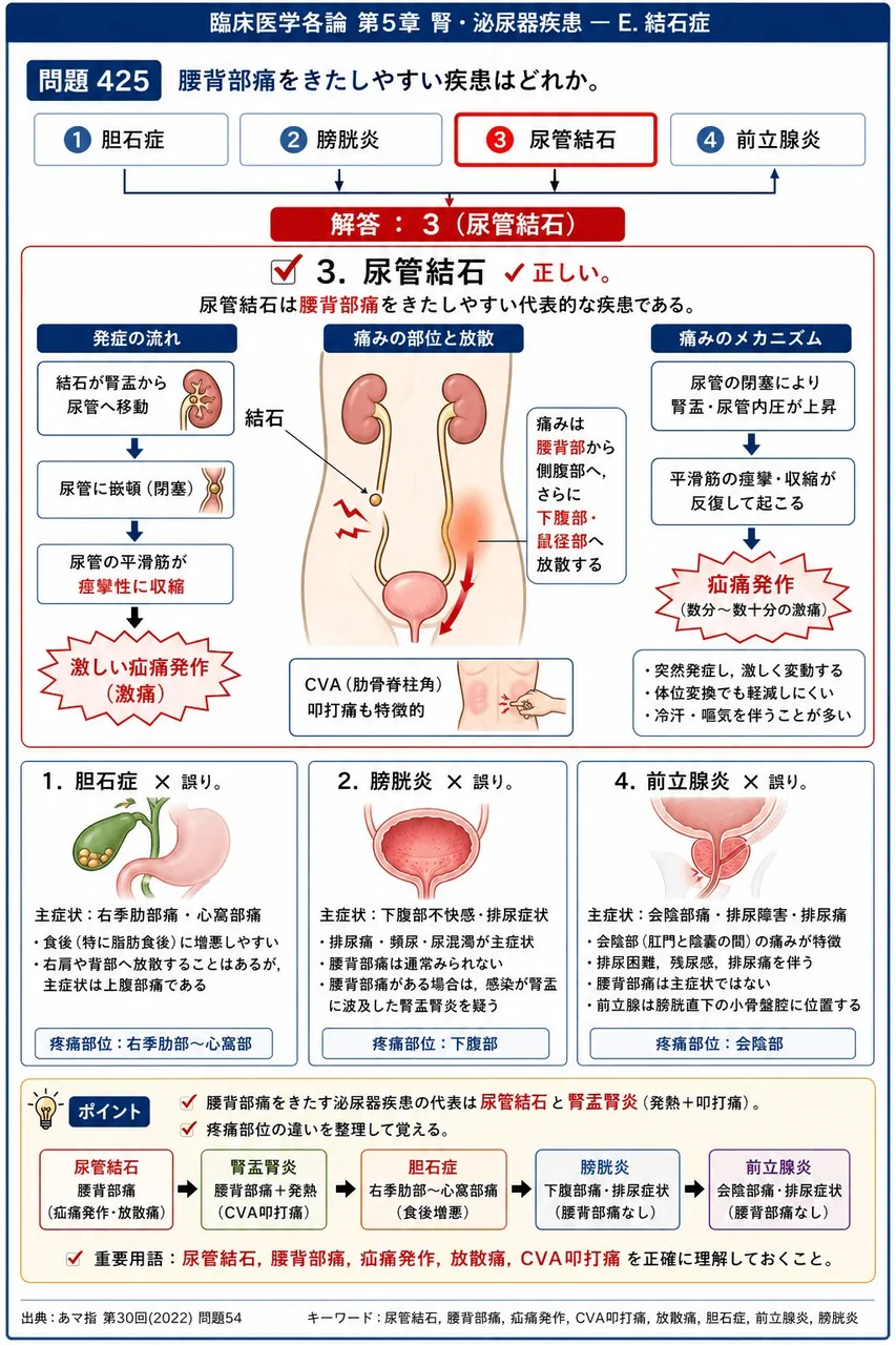 あマ指 第30回(2022) 問題54｜腰背部痛をきたしやすい疾患はどれか。 解説図