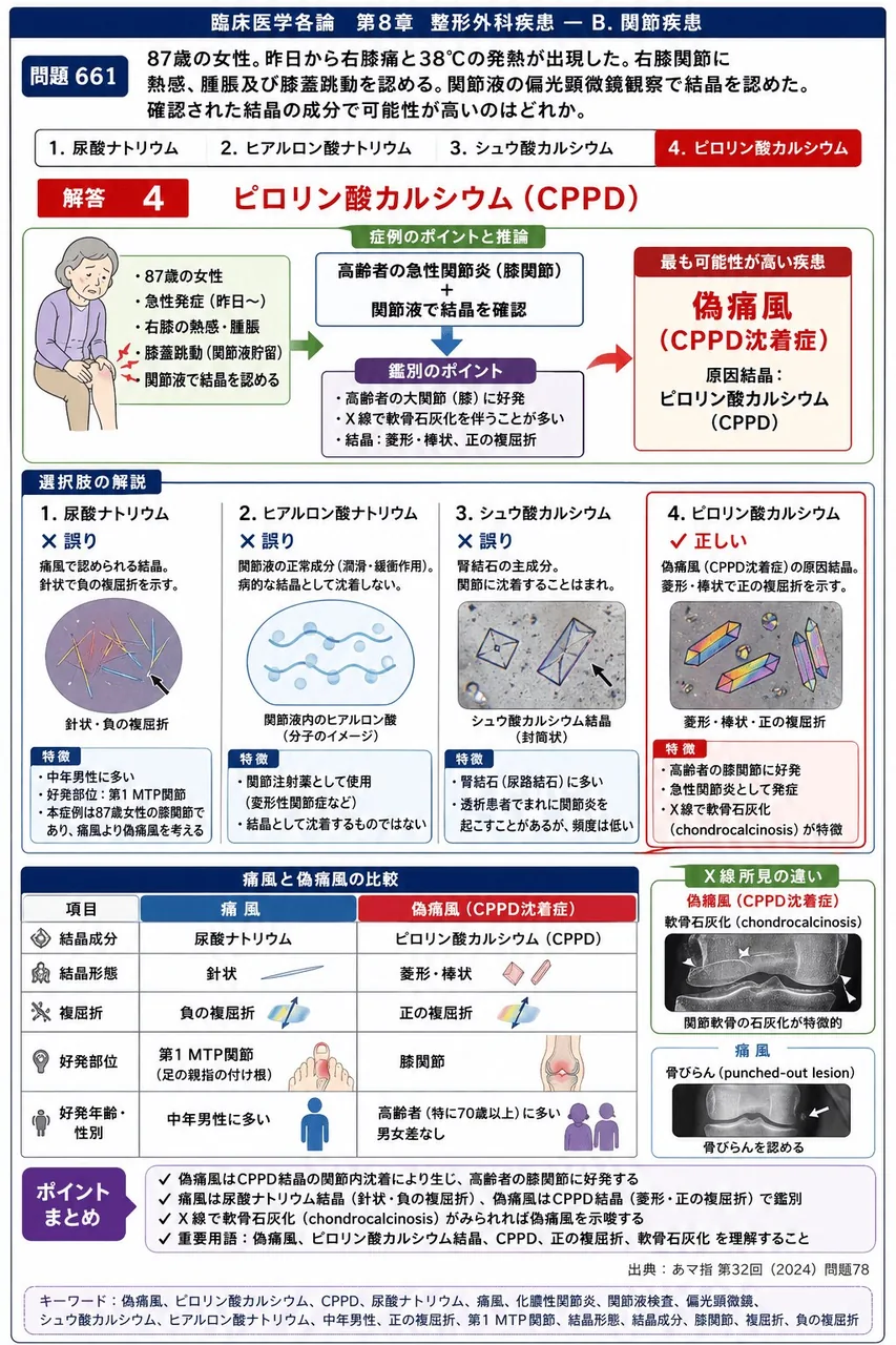 あマ指 第32回(2024) 問題78｜次の文で示す症例について、問いに答えよ。「87歳の女性。昨日から右膝痛と38℃の発熱が出現した。右膝関節に熱感、腫脹及び膝蓋跳動を認める。関節液の偏光顕微鏡観察で結晶を認めた。」確認された結晶の成分で可能性が高いのはどれか。 解説図