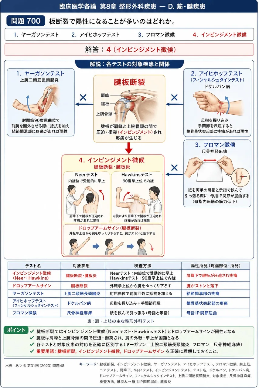 あマ指 第31回(2023) 問題48|板断裂で陽性になることが多いのはどれか。 解説図