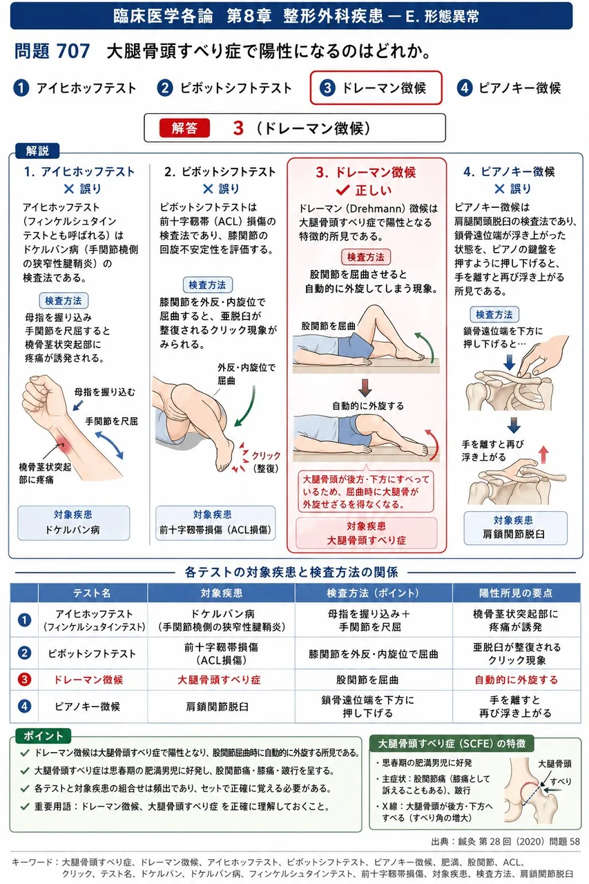 鍼灸 第28回(2020) 問題58|大腿骨頭すべり症で陽性になるのはどれか。 解説図