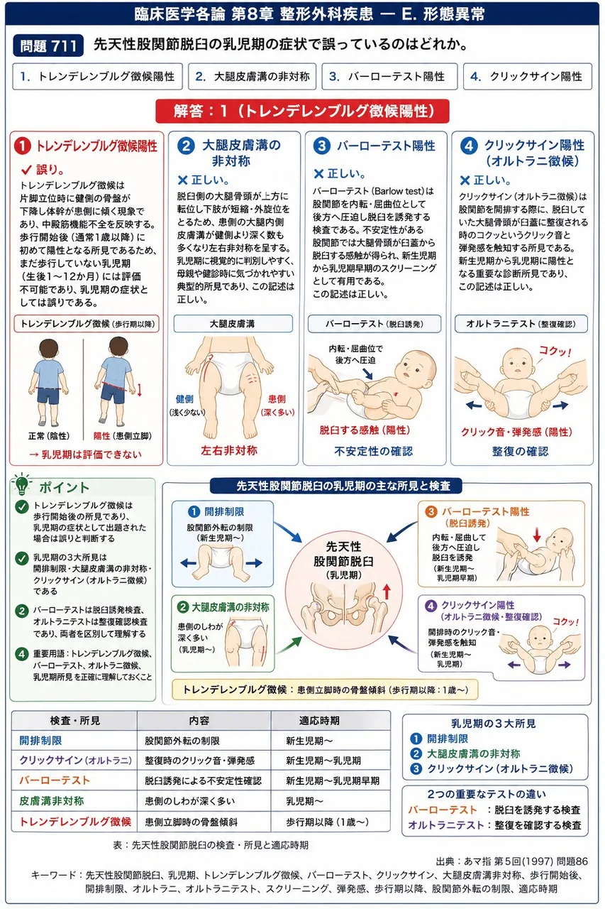 あマ指 第5回(1997) 問題86|先天性股関節脱臼の乳児期の症状で誤っているのはどれか。 解説図