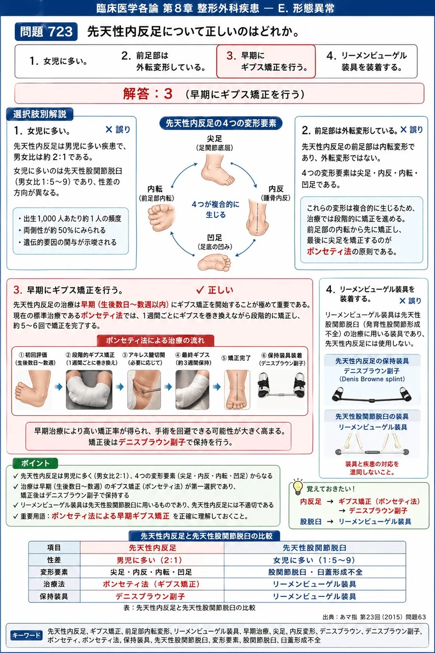 あマ指 第23回(2015) 問題63|先天性内反足について正しいのはどれか。 解説図