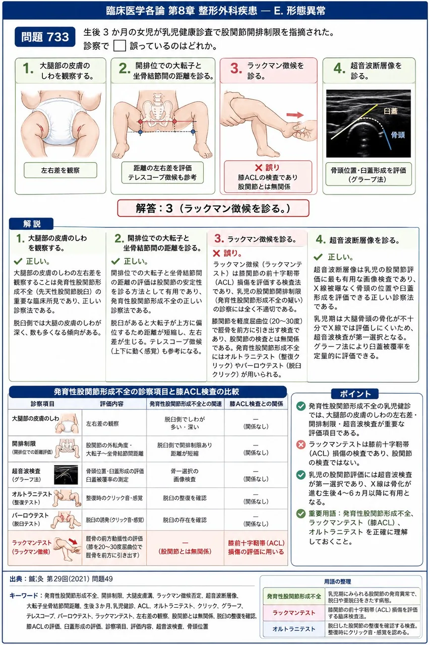 鍼灸 第29回(2021) 問題49｜生後 3 か月の女児が乳児健康診査で股関節開排制限を指摘された。診察で□誤っているのはどれか。 解説図