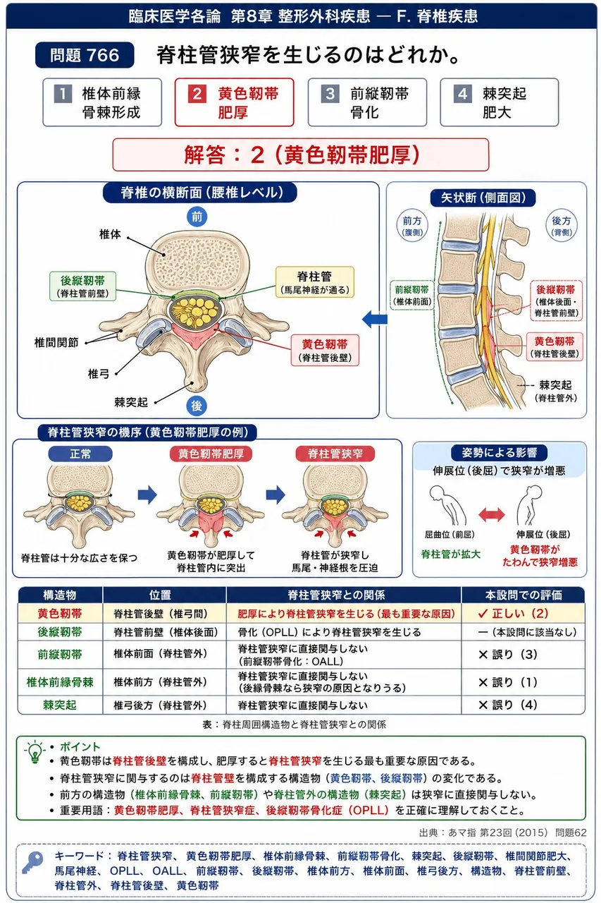あマ指 第23回(2015) 問題62|脊柱管狭窄を生じるのはどれか。 解説図