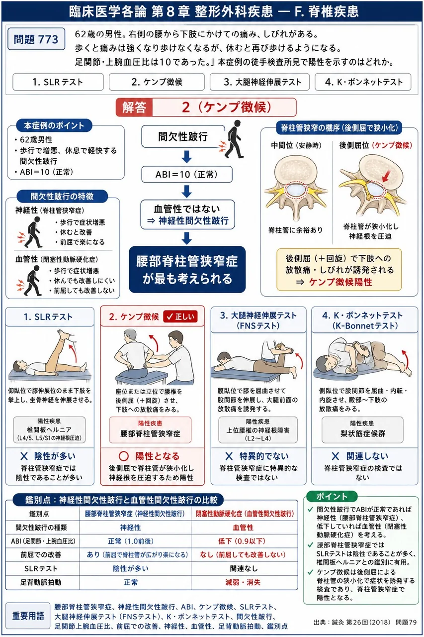 鍼灸 第26回(2018) 問題79|「62歳の男性。右側の腰から下肢にかけての痛み、しびれがある。歩くと痛みは強くなり歩けなくなるが、休むと再び歩けるようになる。足関節・上腕血圧比は10であった。」本症例の徒手検査所見で陽性を示すのはどれか。 解説図