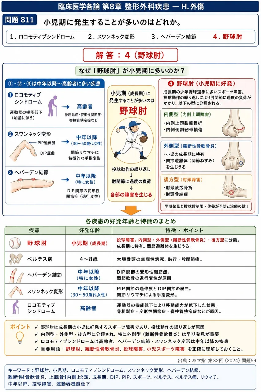 あマ指 第32回(2024) 問題59|小児期に発生することが多いのはどれか。 解説図