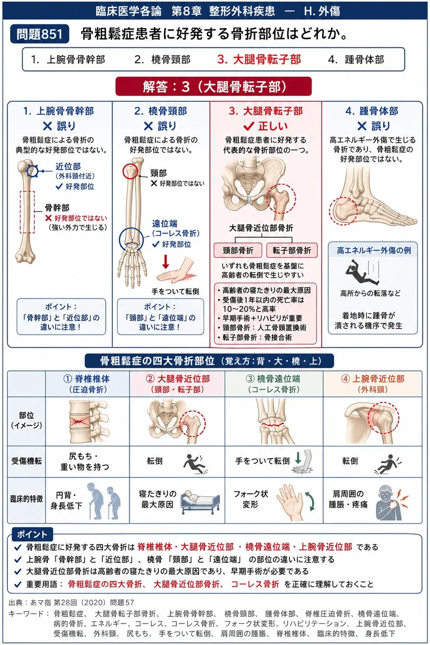 あマ指 第28回(2020) 問題57|骨粗鬆症患者に好発する骨折部位はどれか。 解説図