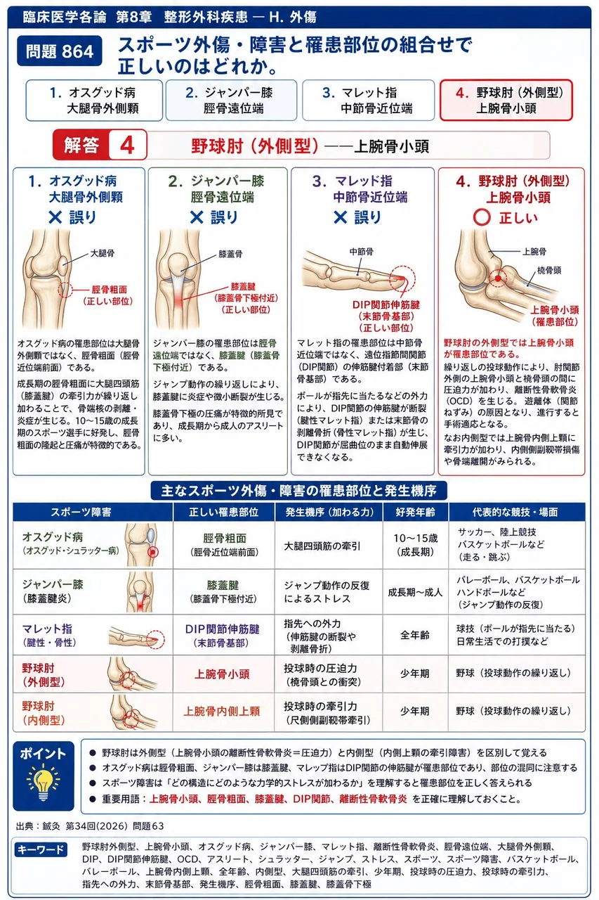 鍼灸 第34回(2026) 問題63|スポーツ外傷・障害と罹患部位の組合せで正しいのはどれか。 解説図