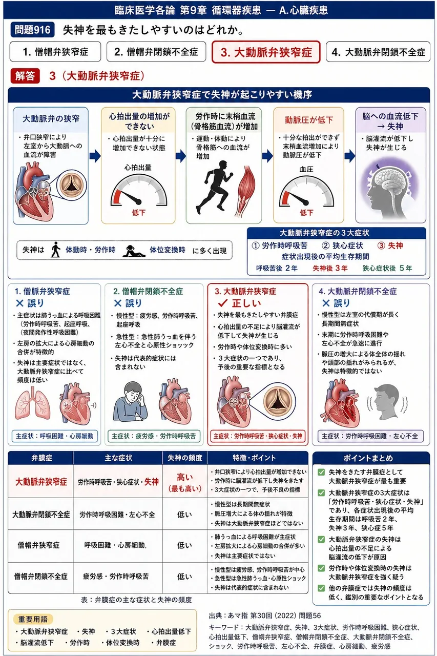 あマ指 第30回(2022) 問題56|失神を最もきたしやすいのはどれか。 解説図