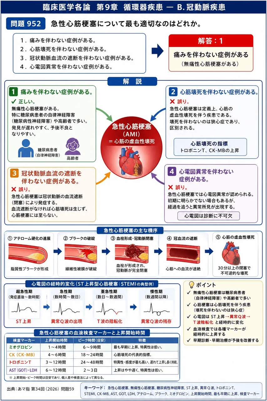 あマ指 第34回(2026) 問題59|急性心筋梗塞について最も適切なのはどれか。 解説図