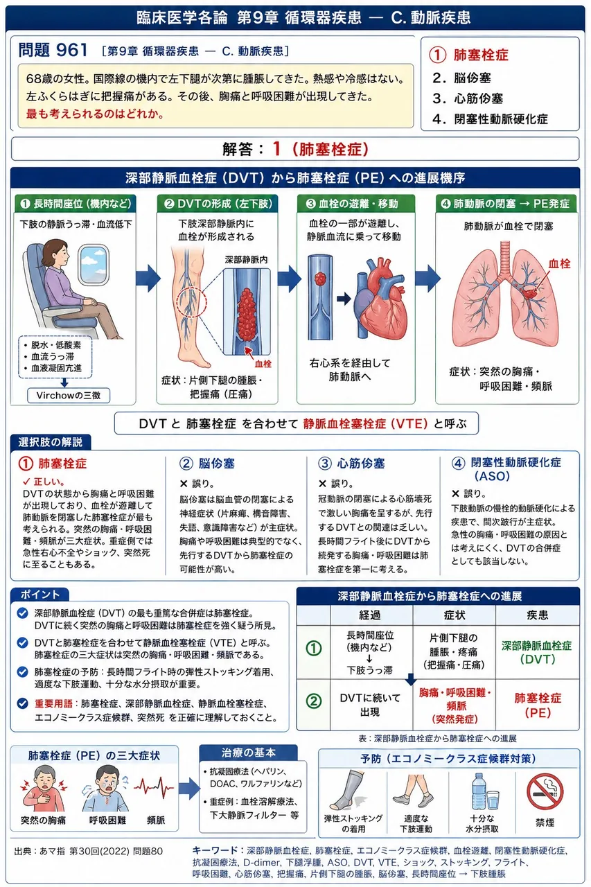 あマ指 第30回(2022) 問題80｜「68歳の女性。国際線の機内で左下腿が次第に腫脹してきた。熱感や冷感はない。 左ふくらはぎに把握痛がある。」その後、胸痛と呼吸困難が出現してきた。最も考えられるのはどれか。 解説図