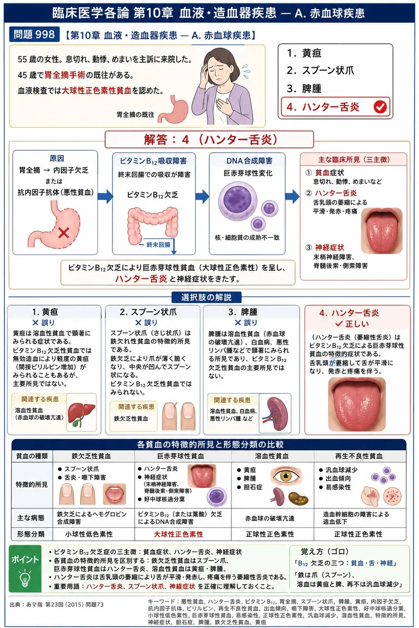 あマ指 第23回(2015) 問題73|「55 歳の女性。息切れ、動悸、めまいを主訴に来院した。45 歳で胃全摘手術の既往がある。血液検査では大球性正色素性貧血を認めた。」本疾患でみられるのはどれか。 解説図