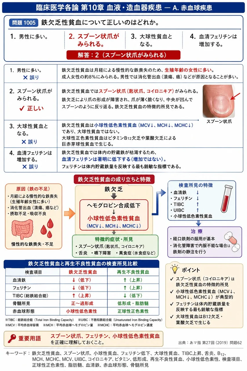 あマ指 第27回(2019) 問題62｜鉄欠乏性貧血について正しいのはどれか。 解説図