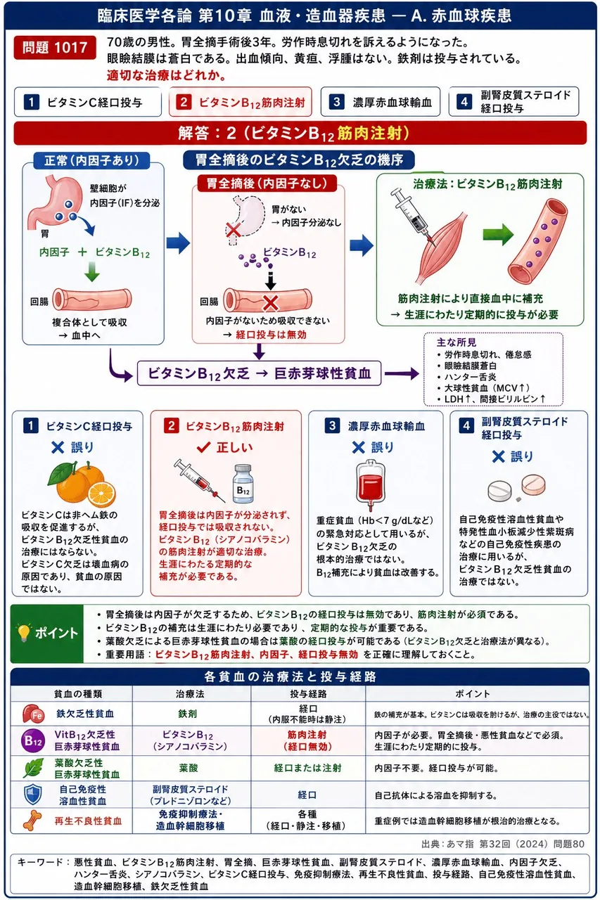あマ指 第32回(2024) 問題80|次の文で示す症例について、問いに答えよ。「70歳の男性。胃全摘手術後3年。労作時息切れを訴えるようになった。眼瞼結膜は蒼白である。出血傾向、黄疸、浮腫はない。鉄剤は投与されている。」適切な治療はどれか。 解説図