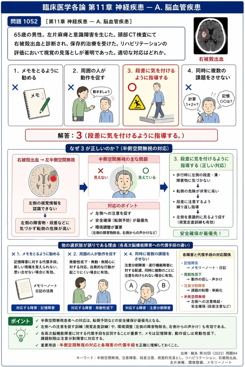 鍼灸 第30回(2022) 問題84｜「65歳の男性。左片麻痺と意識障害を生じた。頭部CT検査にて右被殻出血と診断され、保存的治療を受けた。リハビリテーションの評価において視覚の見落としが著明であった。」適切な対応はどれか。 解説図