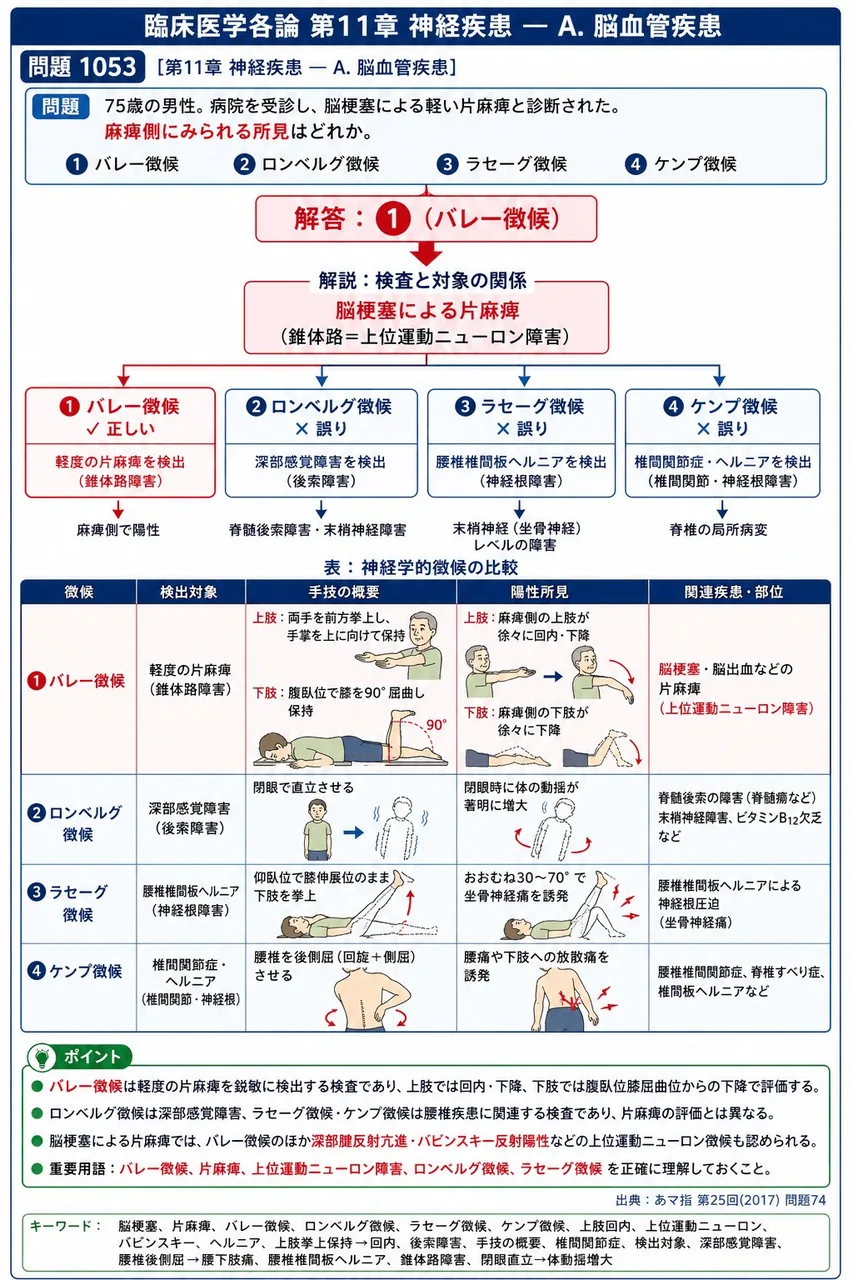 あマ指 第25回(2017) 問題74|「75歳の男性。病院を受診し、脳梗塞による軽い片麻痺と診断された。」麻痺側にみられる所見はどれか。 解説図