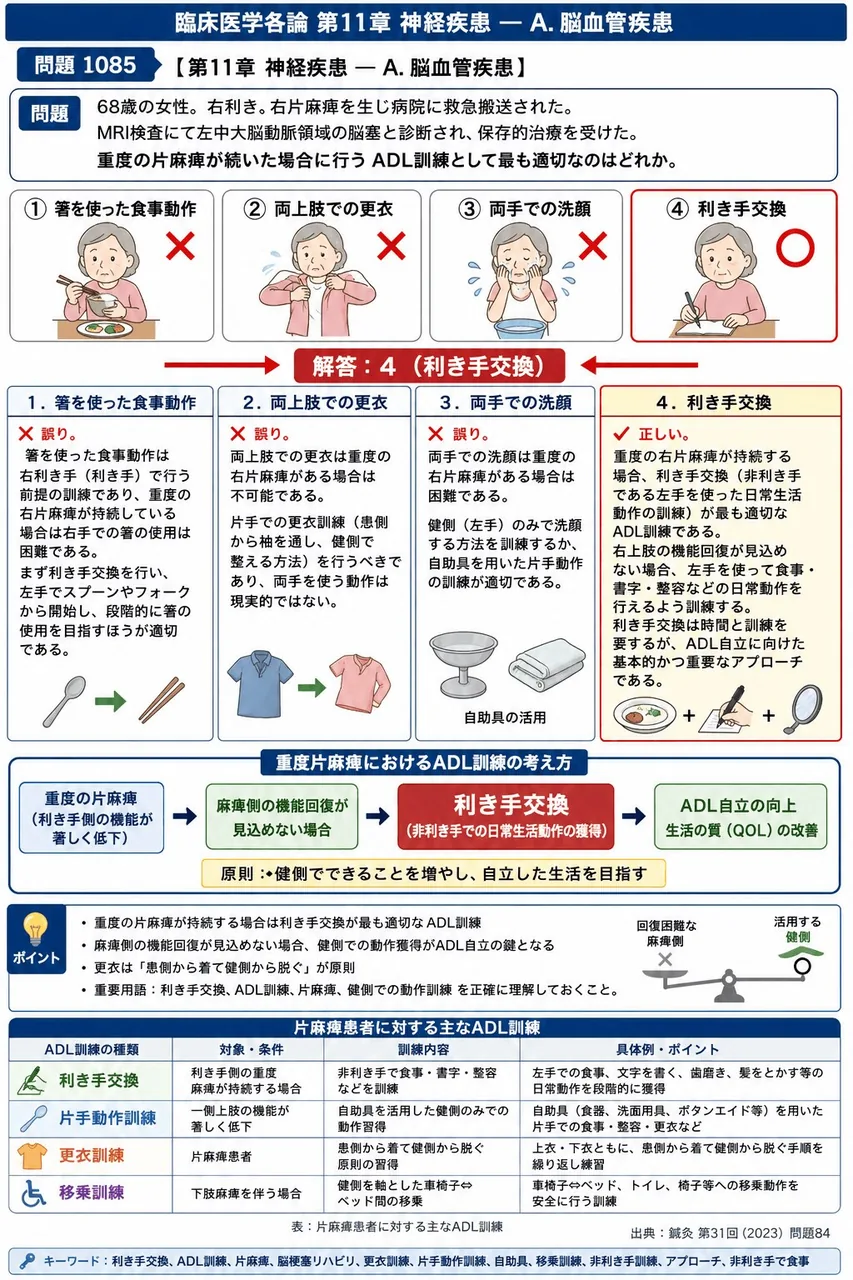 鍼灸 第31回(2023) 問題84|「68歳の女性。右利き。右片麻痺を生じ病院に救急搬送された。MRI検査にて左中大脳動脈領域の脳塞と診断され、保存的治療を受けた。」重度の片麻痺が続いた場合に行う ADL訓練として最も適切なのはどれか。 解説図
