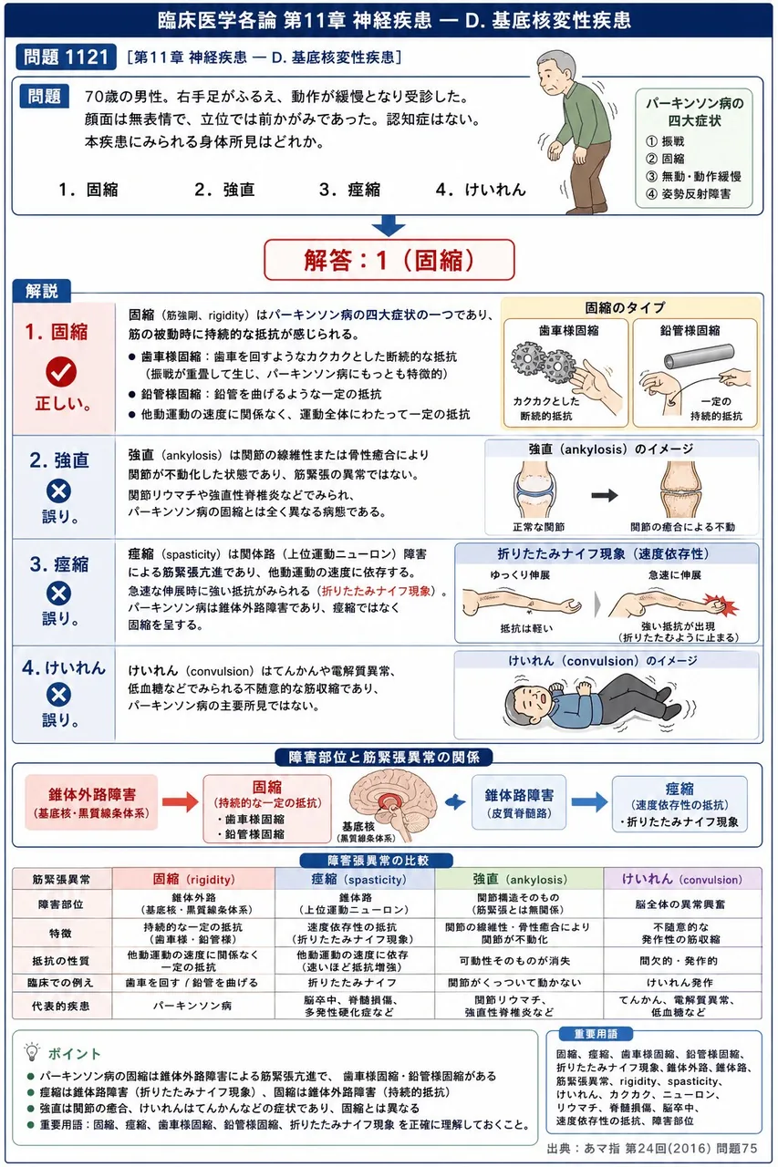 あマ指 第24回(2016) 問題75|「70歳の男性。右手足がふるえ、動作が緩慢となり受診した。顔面は無表情で、立位では前かがみであった。認知症はない。」本疾患にみられる身体所見はどれか。 解説図