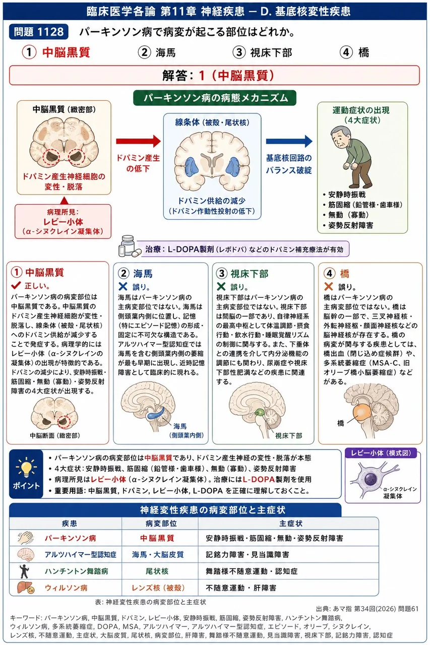 あマ指 第34回(2026) 問題61|パーキンソン病で病変が起こる部位はどれか。 解説図