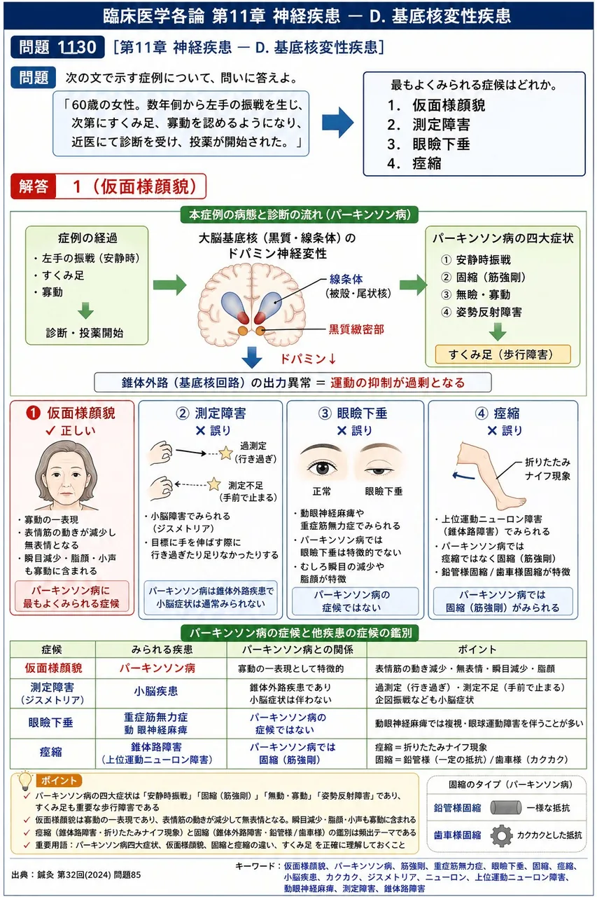 鍼灸 第32回(2024) 問題85｜次の文で示す症例について、問いに答えよ。「60歳の女性。数年前から左手の振戦を生じ、次第にすくみ足、寡動を認めるようになり、近医にて診断を受け、投薬が開始された。」最もよくみられる症候はどれか。 解説図