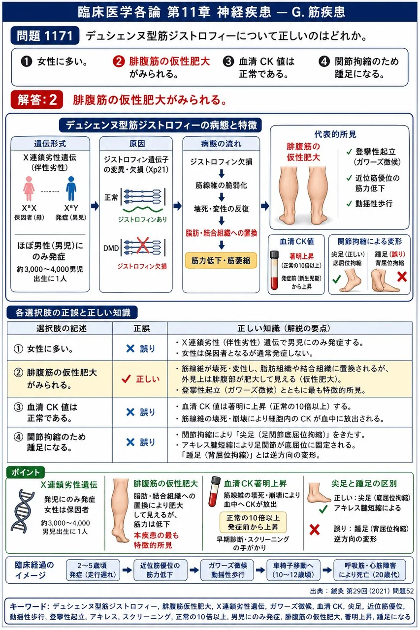鍼灸 第29回(2021) 問題52｜デュシェンヌ型筋ジストロフィーについて正しいのはどれか。 解説図