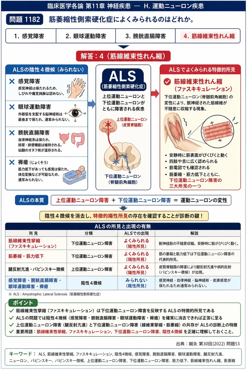 鍼灸 第30回(2022) 問題53|筋萎縮性側索硬化症によくみられるのはどれか。 解説図