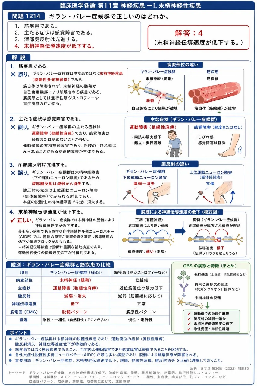 あマ指 第30回(2022) 問題50|ギラン・バレー症候群で正しいのはどれか。 解説図