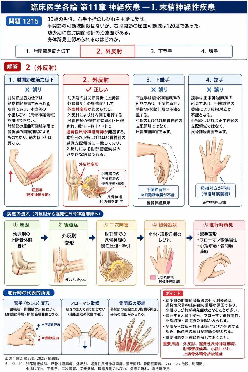 鍼灸 第33回(2025) 問題85｜次の症例について、「30歳の男性。右手小指のしびれを主訴に受診。手関節の可動域制限はないが、右肘関節の屈曲可動域は120度であった。幼少期に右肘関節骨折の治療歴がある。」身体所見上認められるのはどれか。 解説図