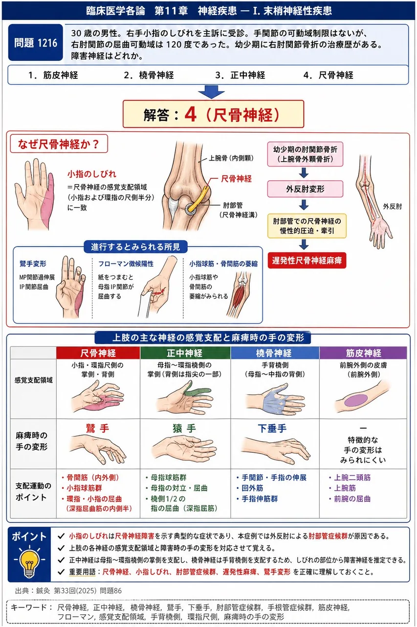 鍼灸 第33回(2025) 問題86｜次の症例について、「30歳の男性。右手小指のしびれを主訴に受診。手関節の可動域制限はないが、右肘関節の屈曲可動域は120度であった。幼少期に右肘関節骨折の治療歴がある。」障害神経はどれか。 解説図