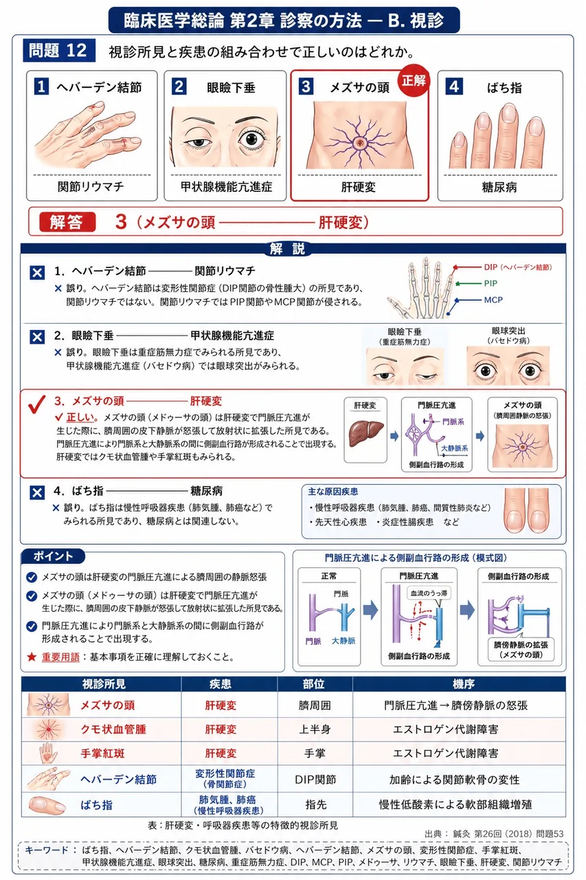 鍼灸 第26回(2018) 問題53|視診所見と疾患の組み合わせで正しいのはどれか。 解説図