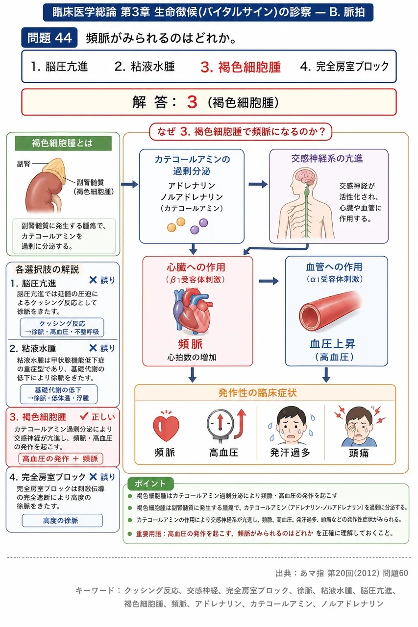 あマ指 第20回(2012) 問題60｜頻脈がみられるのはどれか。 解説図