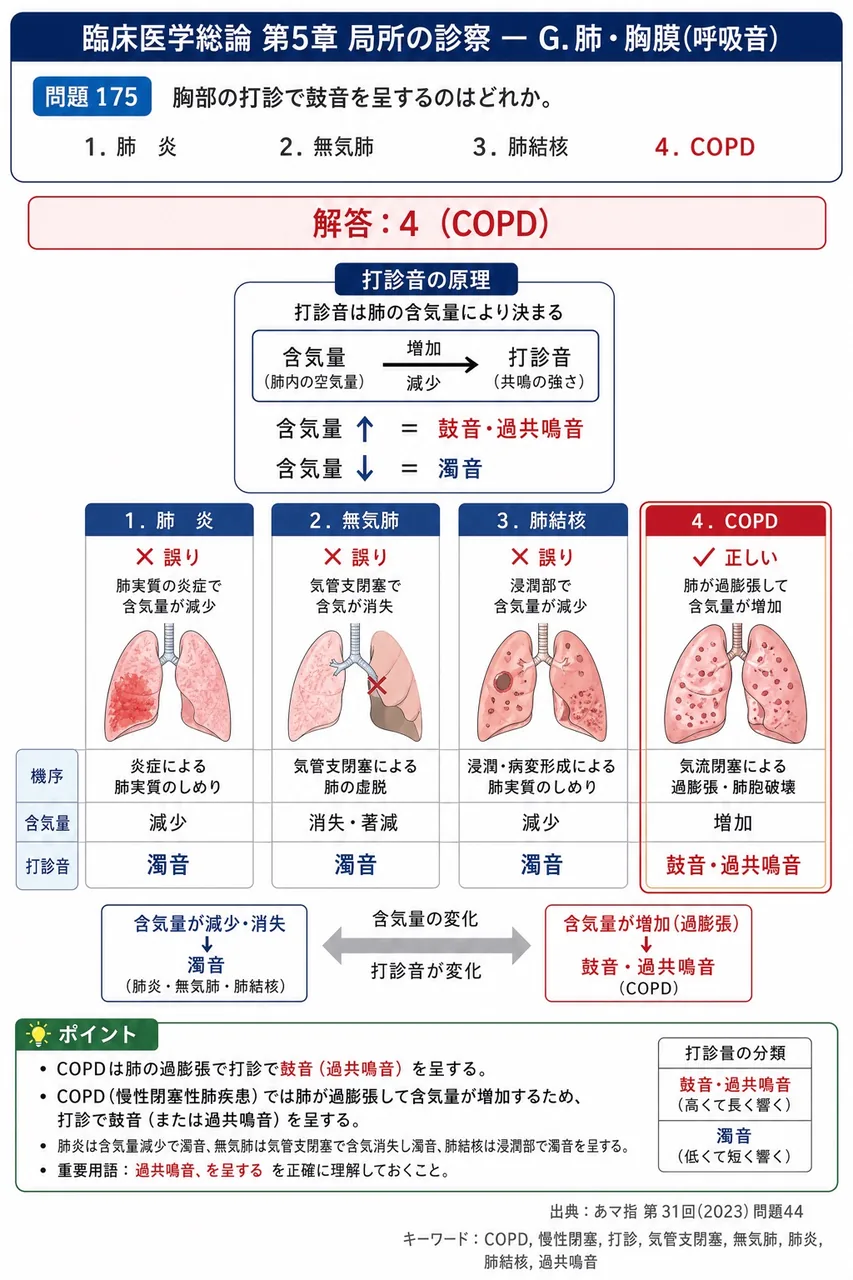 あマ指 第31回(2023) 問題44｜胸部の打診で鼓音を呈するのはどれか。 解説図